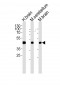 GABRG1 Antibody (C-term)